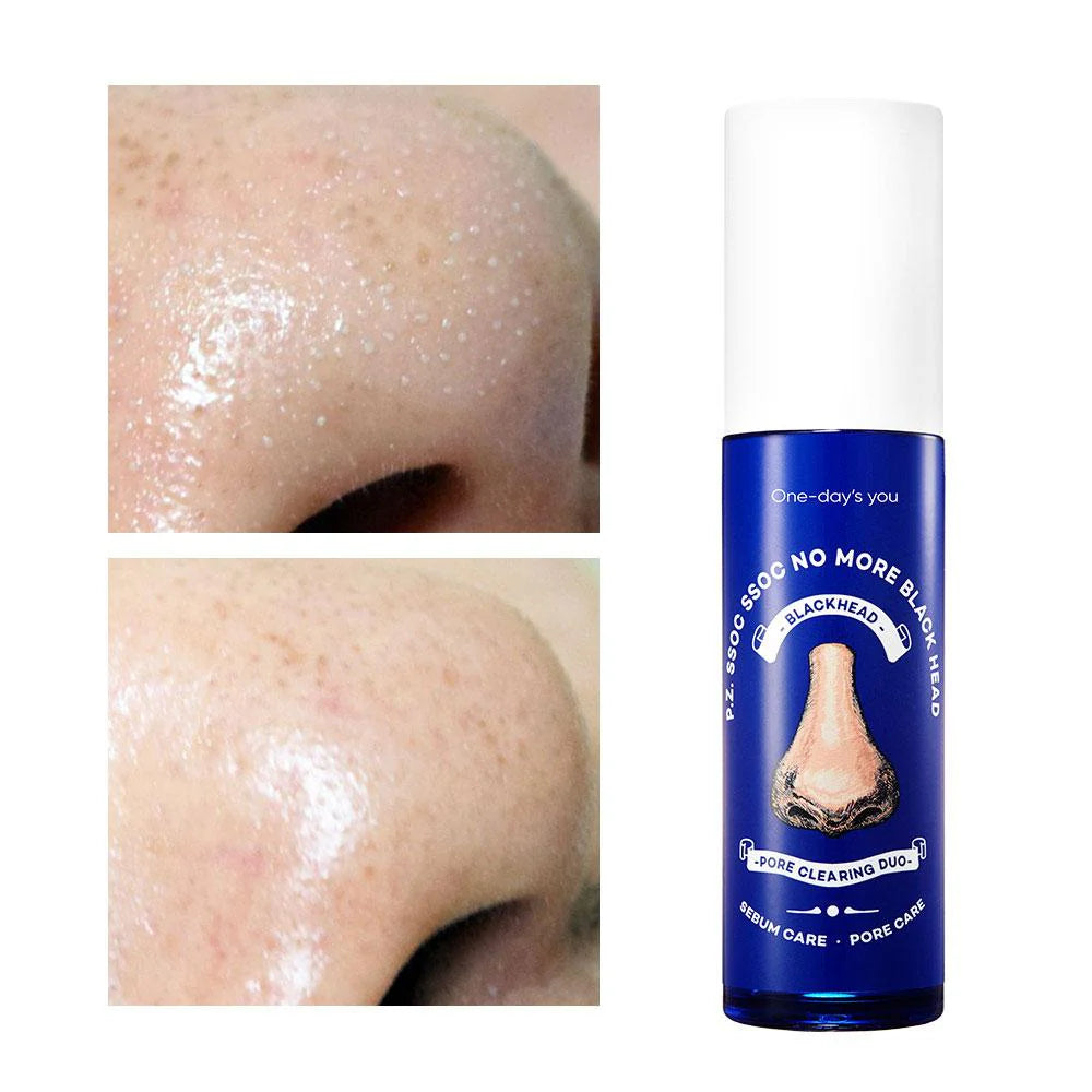 One-day's you P.Z Ssoc Ssoc No More Black Head 100ml