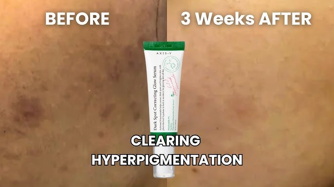 AXIS-Y Dark Spot Correcting Glow Serum 50ml