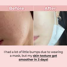 Numbuzin No.3 Tingle-Pore Softening Sheet Mask 4ea