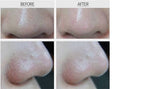 RIRE Style Blackhead Brush Cleanser (With Built-In Silicone Massager) 20ml