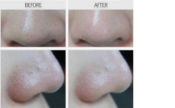 RIRE Style Blackhead Brush Cleanser (With Built-In Silicone Massager) 20ml