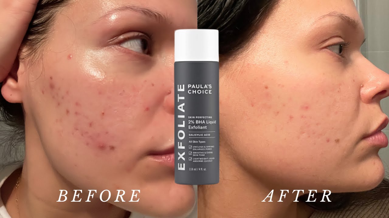 Paula's Choice Skin Perfecting 2% BHA Liquid Exfoliant 118ml