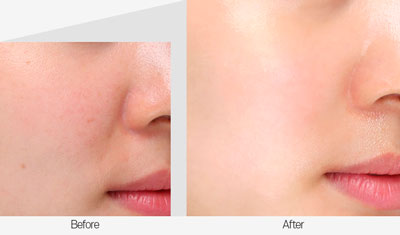 Medipeel Mezzo Filla Eye Serum 30ml