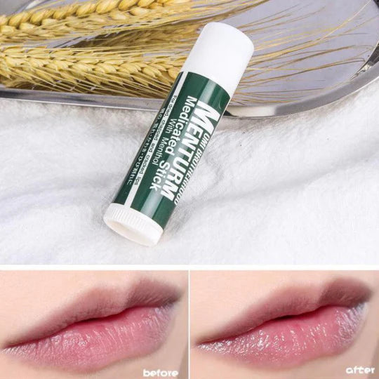 OMI 近江兄弟 日本 藥用防乾燥潤唇膏 (薄荷) 4g