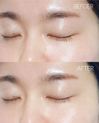 BEPLAIN Cicaterol Ampoule Upgraded Version 30ml