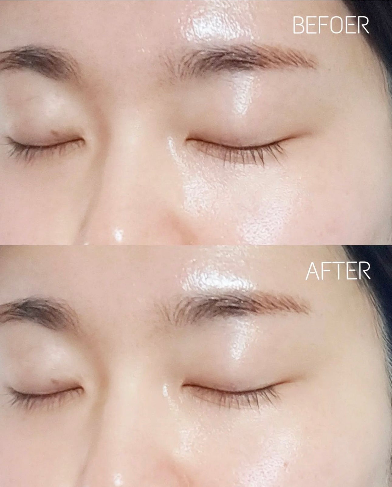 Beplain 升級版 純素濃縮積雪草修復精華 30ml