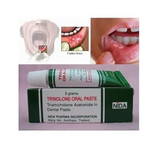 Nida Oral Ointment for Mouth Ulcers and Stomatitis 5g