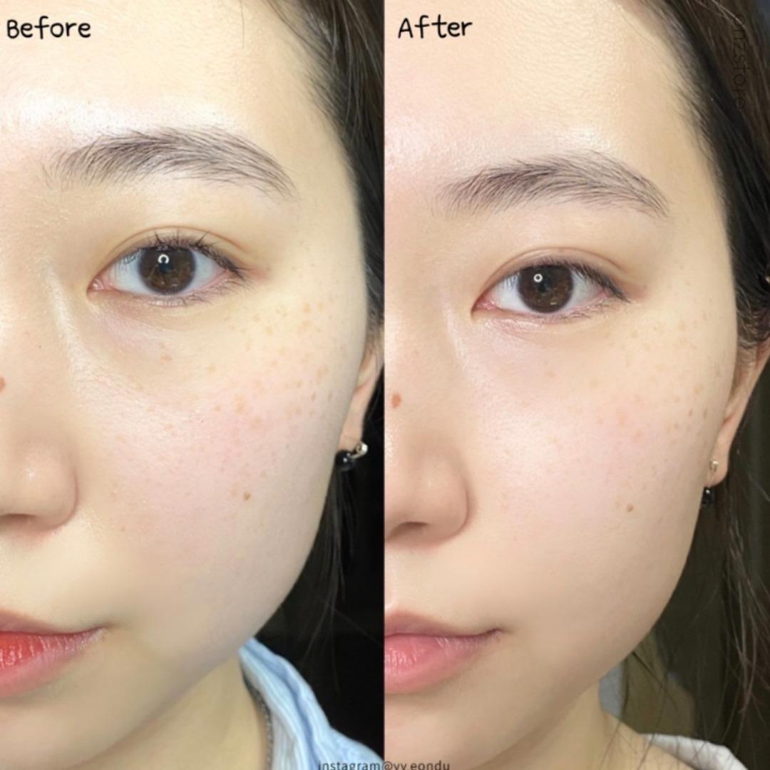 Fillimilli 韓國 V臉按摩器 1件