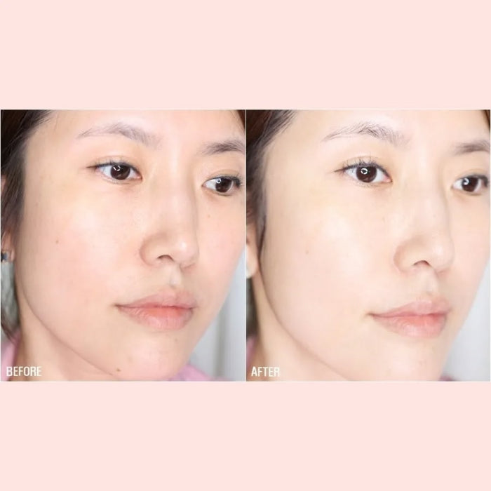 Hanmi PRO CALM Red X Cream (Reduce Dkin Discoloration) 18ml