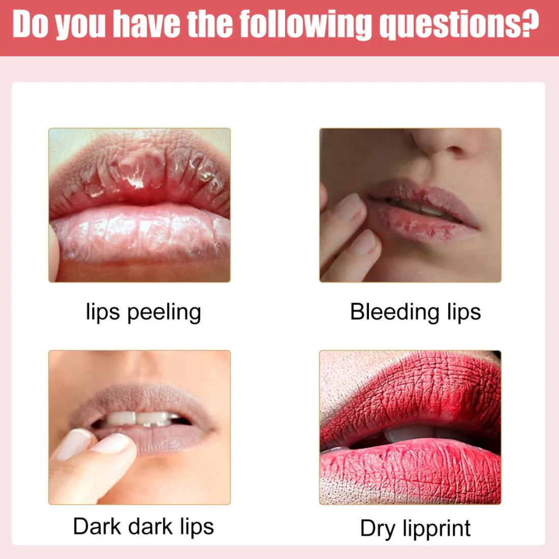 Eelhoe Moisturizing Brightening  Lip Cream 30g