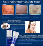 PAIR Acne Creamy Foam Facial Washing Foam 80g