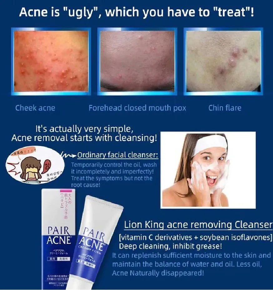 PAIR Acne Creamy Foam Facial Washing Foam 80g