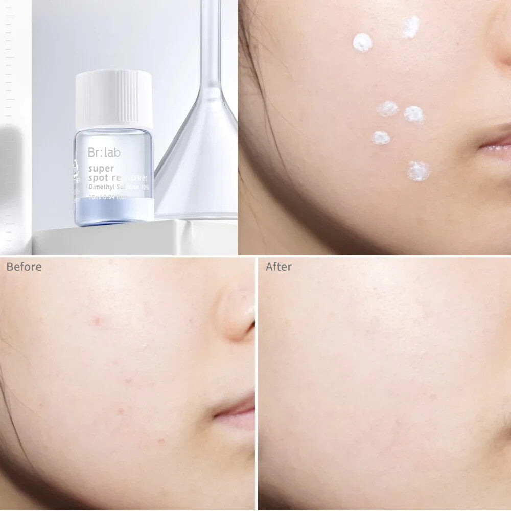 BR:LAB Tea Tree Super Acne Spot Remover 10ml
