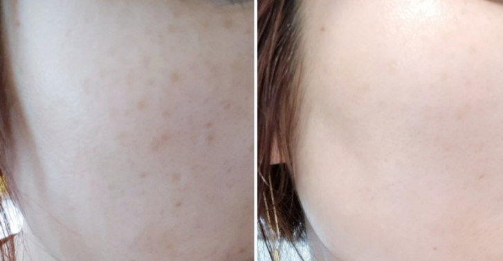 TG Dominas Whitening Cream RX (Freckles Care & Blemish Care) 50g