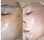 Beaute Melasma-X 3D Whitening Clinic Renewal Cream 40ml