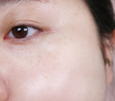 TG Dominas Whitening Cream RX (Freckles Care & Blemish Care) 50g