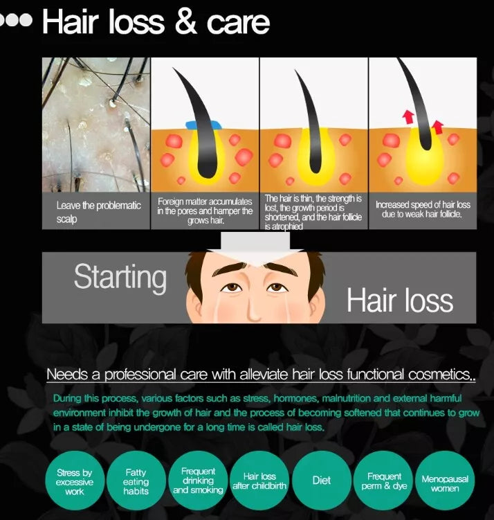 Daycell 韓國 MoBalA 魚腥草防脫育髮噴霧 150ml