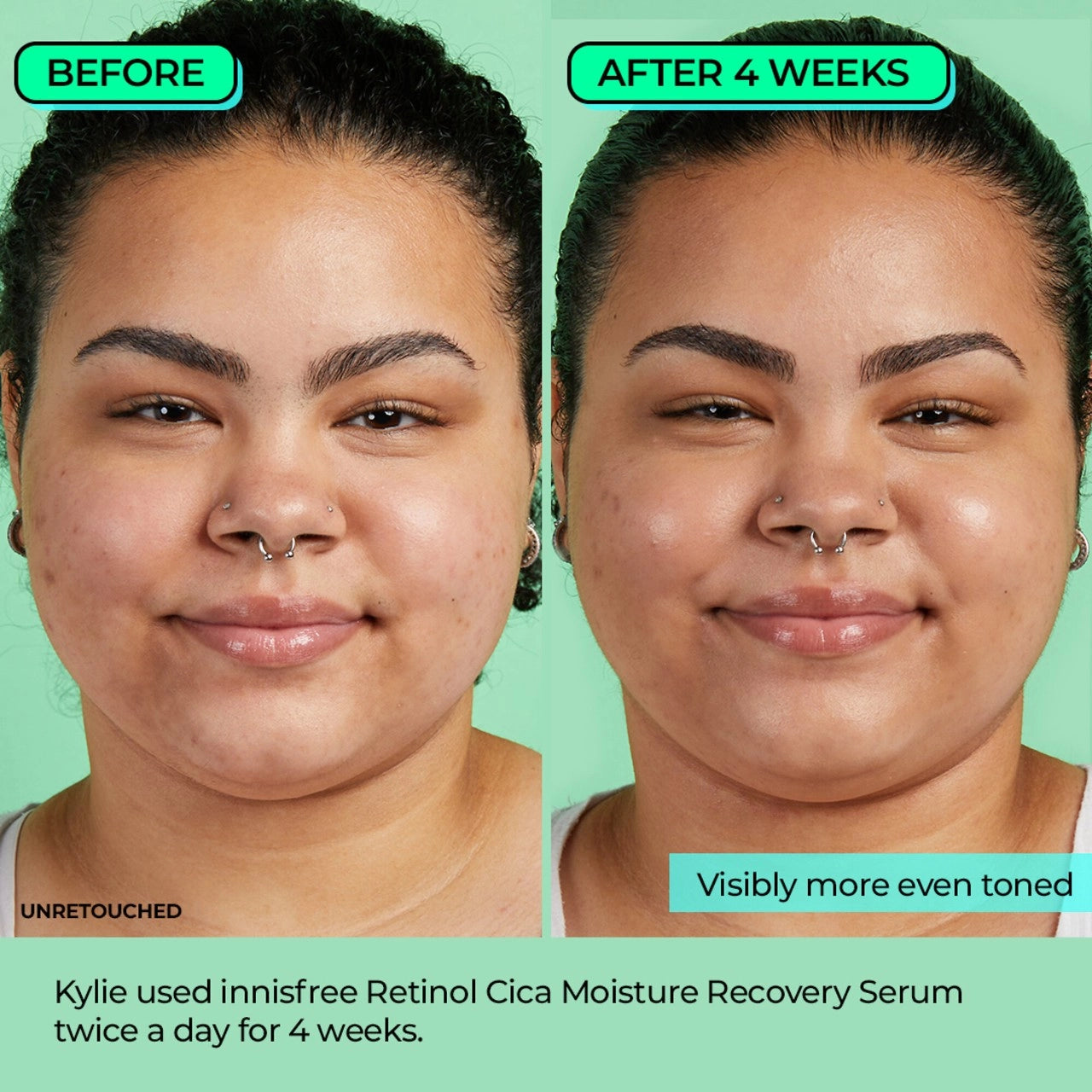 INNISFREE 韓國 視黃醇 速效淨肌修護精華 30ml