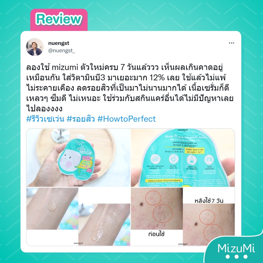 MizuMi B3 Acne Concentrate Serum 13g