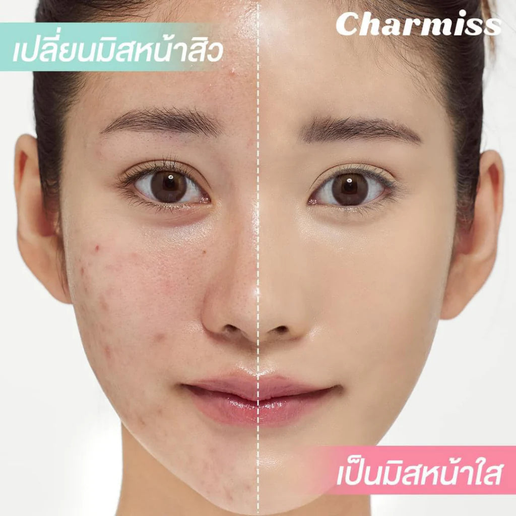 Charmiss Matte All Day Acne Cushion SPF50 PA++++ 8g