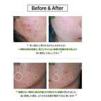 Dong-A Pharm Fation Noscar9 Trouble Serum (Sebum Control) 50ml