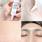 CLEAR NOSE Tea Tree Alcohol-Free Acne Gel Concentrate Solution 4g/15g