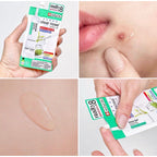 CLEAR NOSE Tea Tree Alcohol-Free Acne Gel Concentrate Solution 4g/15g