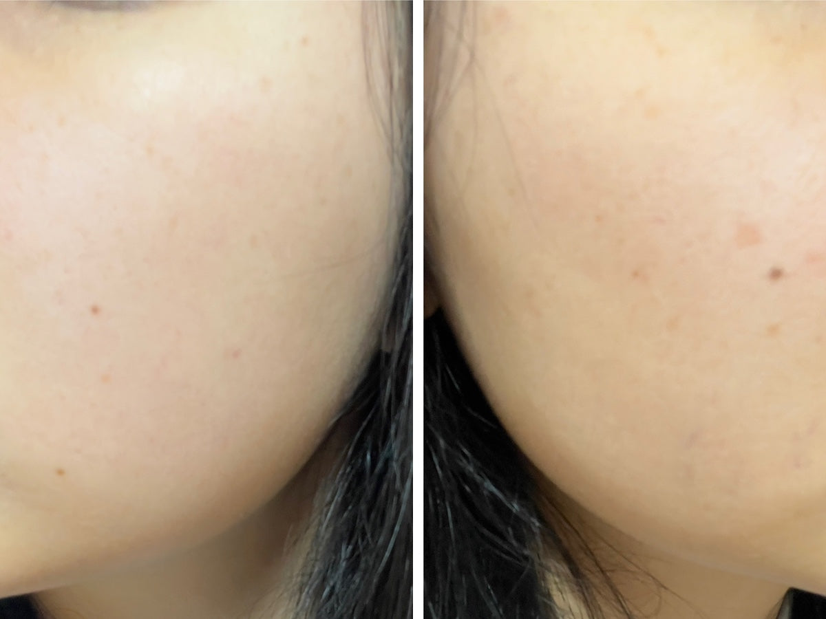 VT Reedle Shot 100 Essence 50ml