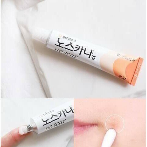 Dong-A Pharm Noscarna Scar Gel (Treat Keloid, Surgery & Acne Scars) 20g