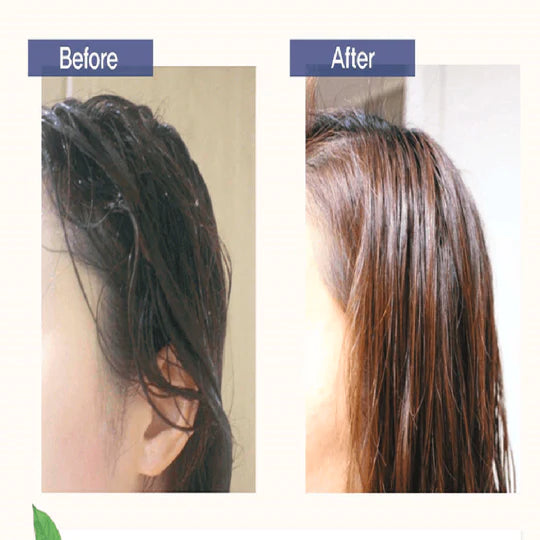 DAYCELL 韓國 MBA 升級版魚腥草 生髮黑髮精華滾珠 20ml