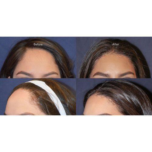 DAYCELL 韓國 MBA 升級版魚腥草 生髮黑髮精華滾珠 20ml