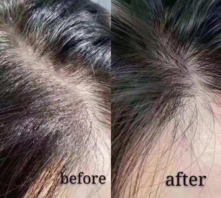 DAYCELL 韓國 MBA 升級版魚腥草 生髮黑髮精華滾珠 20ml